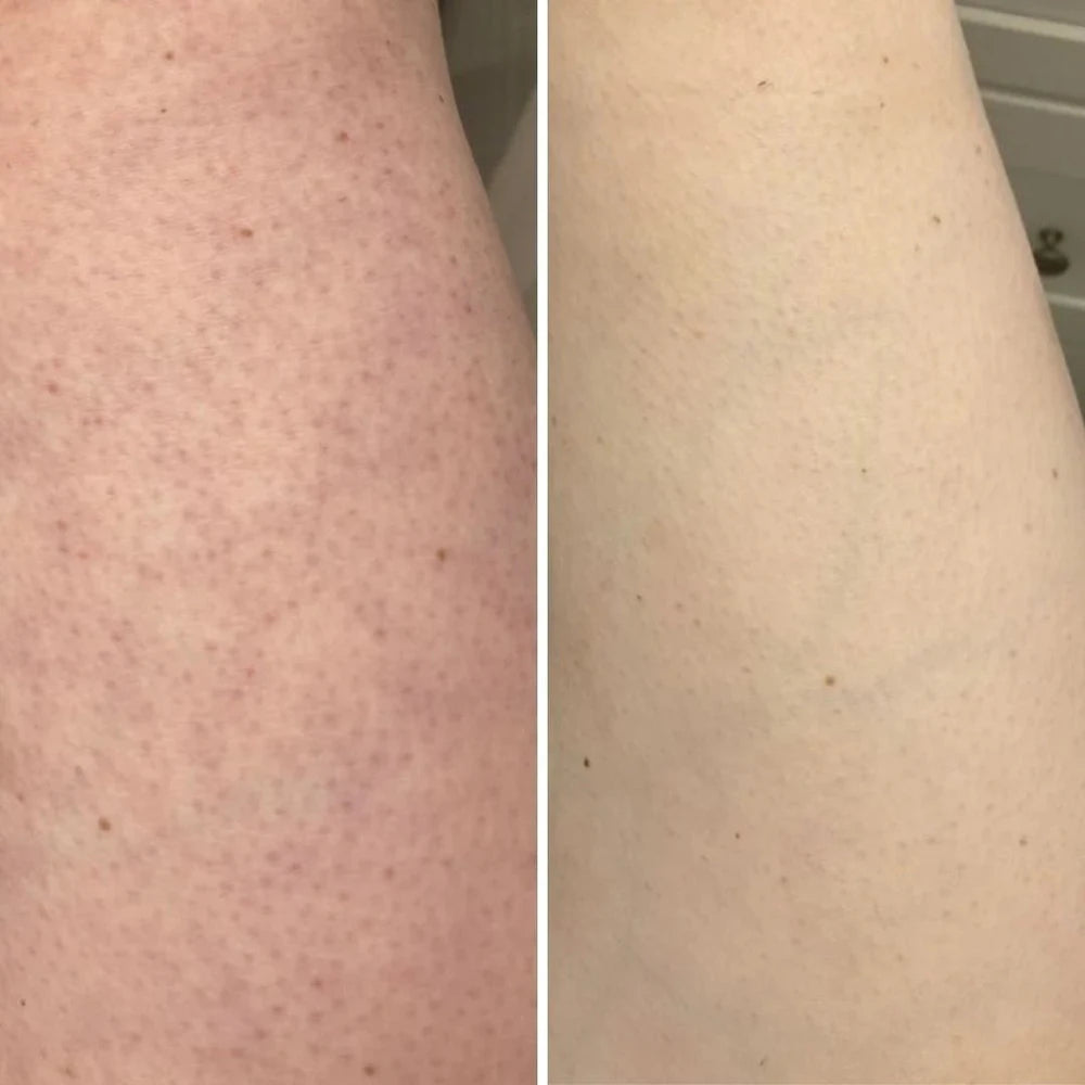 Glow Body Brush™