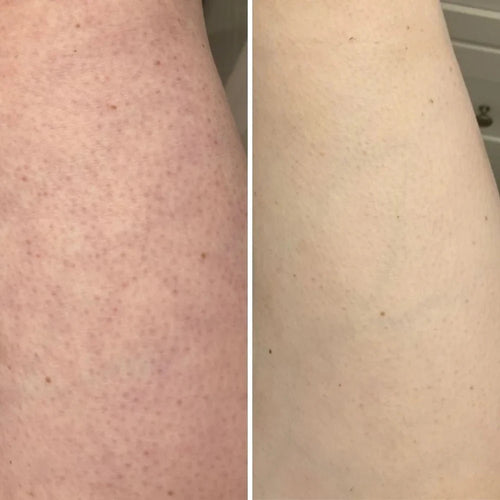 Glow Body Brush™